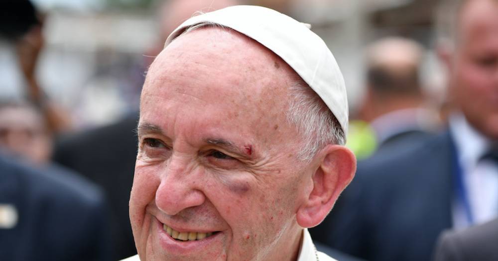 В Колумбии папа римский получил травму, ударившись в папамобиле