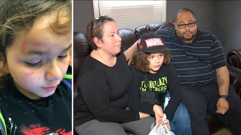 Родители 9-летнего мальчика-аутиста считают, что их сына побил сотрудник школьного автобуса