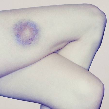 Что женщины должны знать о домашнем насилии