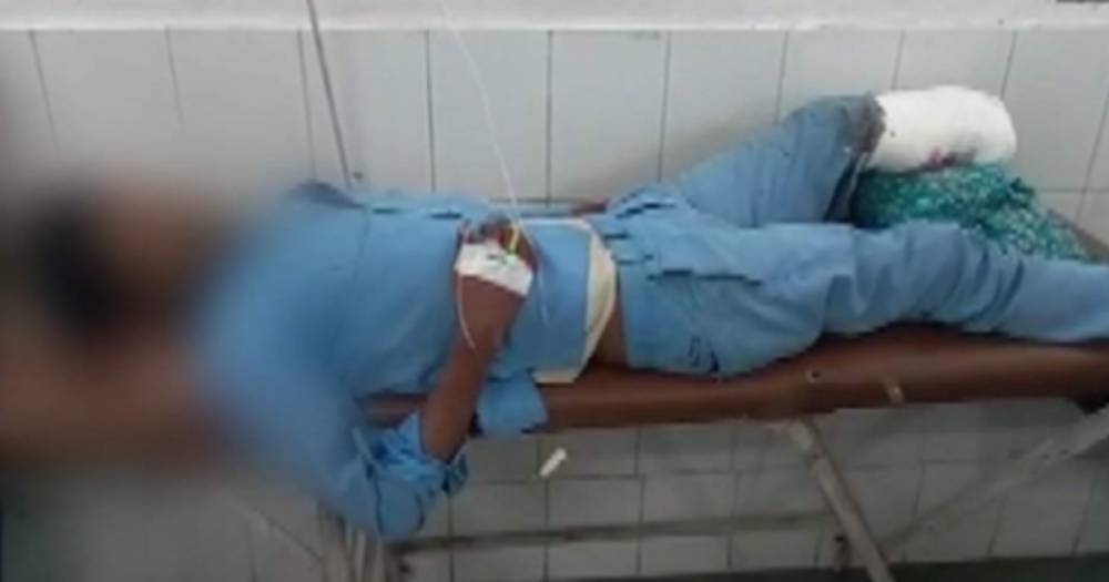 В Индии врачи использовали ампутированную ногу пациента как подушку