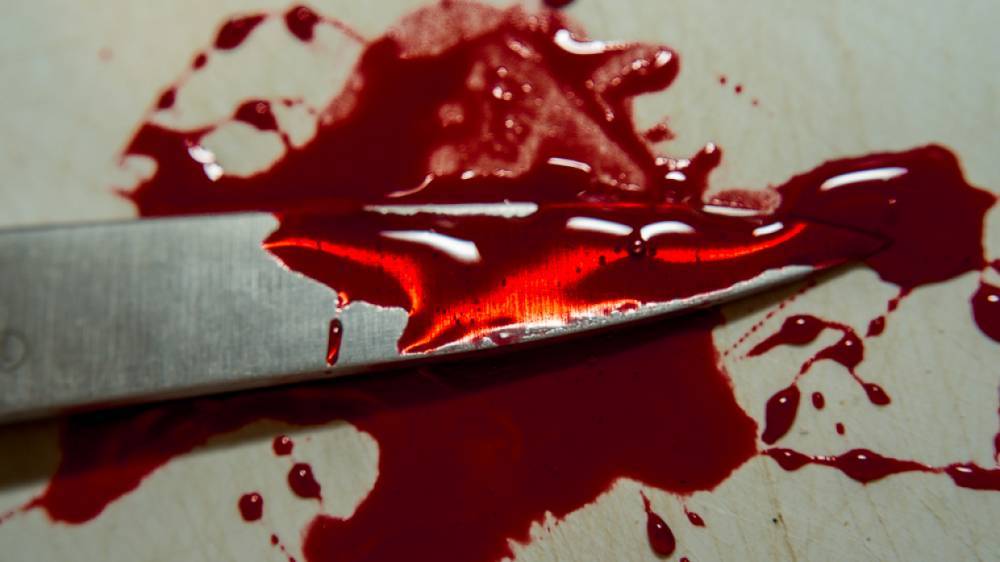 В Апатитах пьяная женщина исколола сожителя кухонным ножом