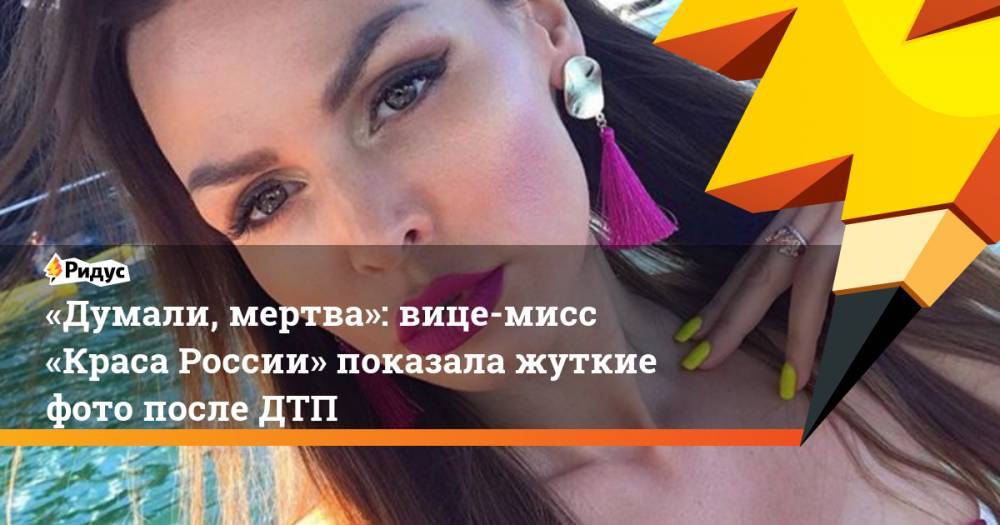 «Думали, мертва»: вице-мисс «Краса России» показала жуткие фото после ДТП