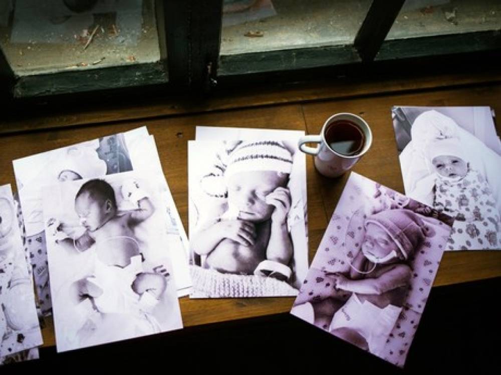 В Архангельске создают фотовыставку счастливых историй о недоношенных детях