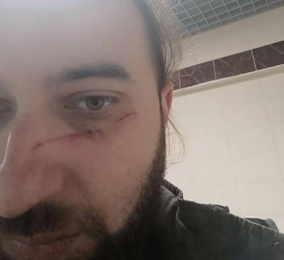 Редактор РИА «Новости» заявил, что его избили на курсах военных журналистов в Крыму