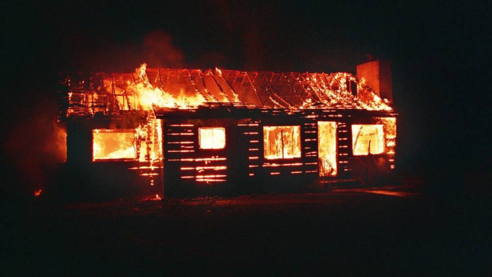 Жителя Усть-Усы доставили в больницу с серьезными ожогами из-за загоревшейся на нем одежды