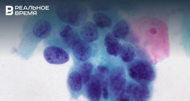 Ученые нашли способы борьбы с неизлечимым раком