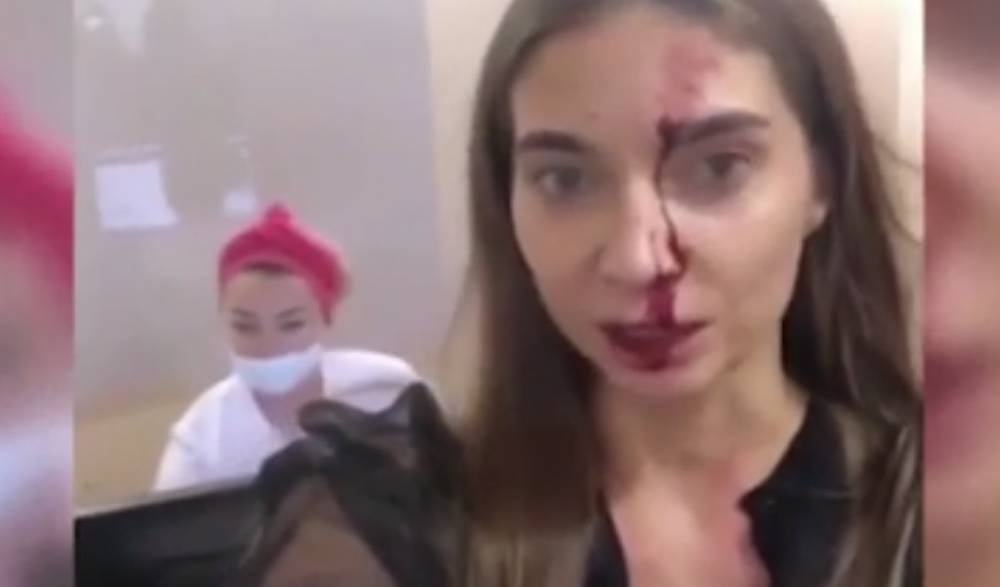Врач сломала девушке нос из-за просьбы показать документы на препарат