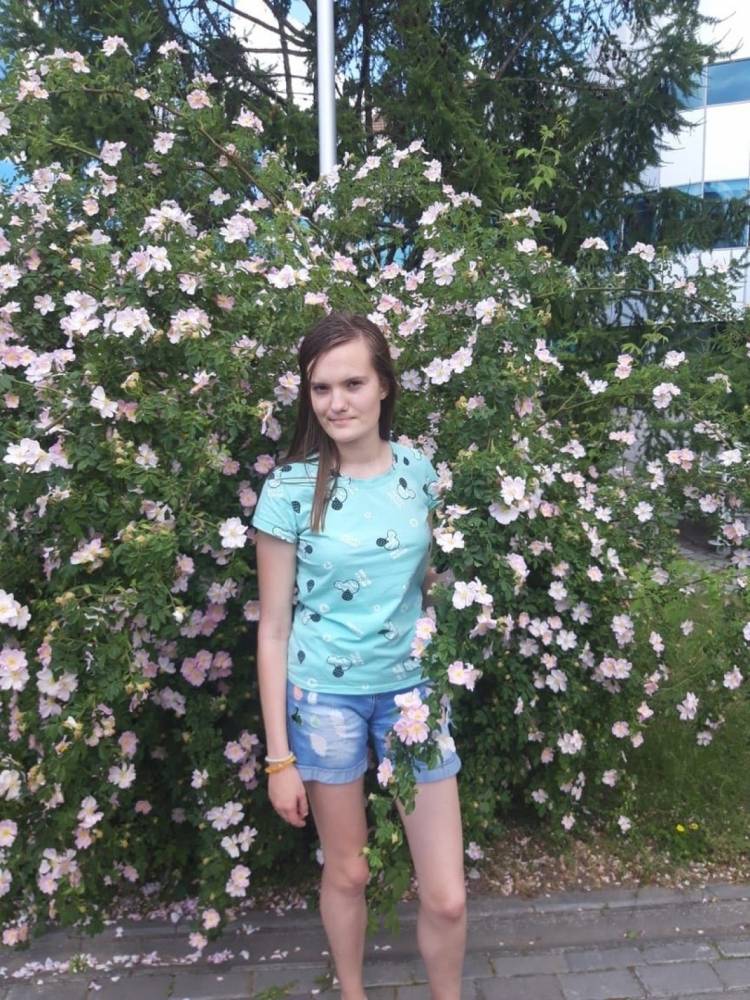 В Калининграде пропала 16-летняя школьница со шрамом на лбу