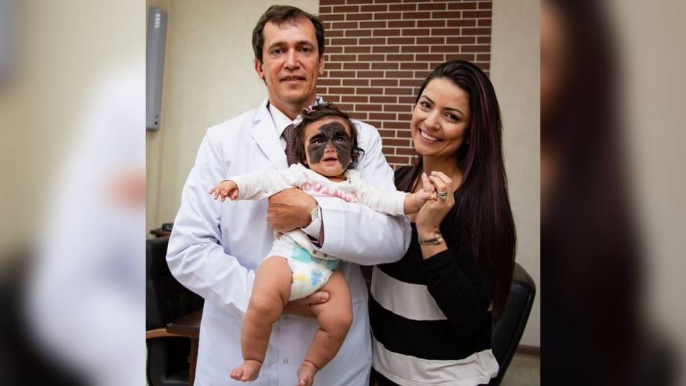 Американскую девочку с родимым пятном на лице готовят к операции в Краснодаре