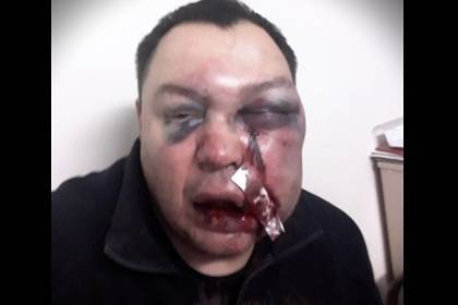 Российского депутата избили железной трубой