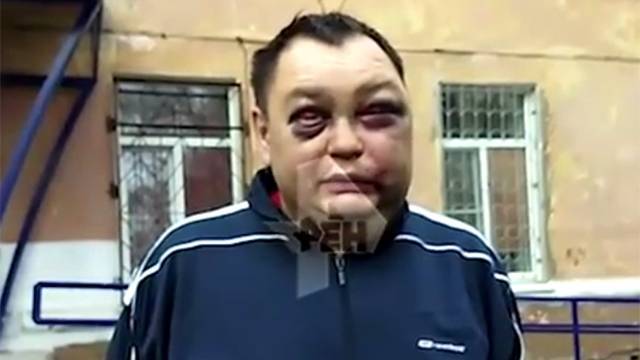 Губернатор Левченко отреагировал на зверское избиение своего оппонента