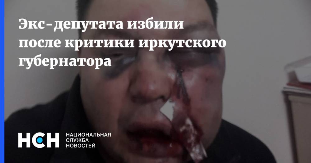 Экс-депутата избили после критики иркутского губернатора