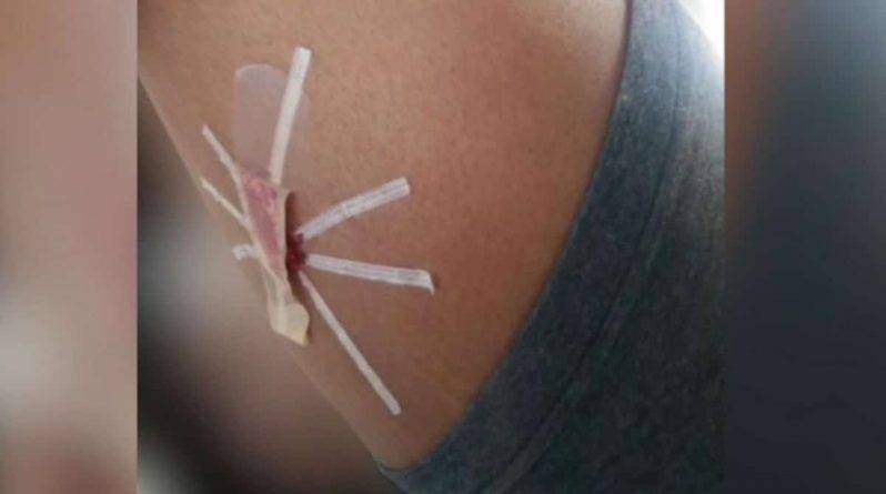 «Я не обязана с Вами ничего обсуждать»: школьная медсестра ввела девочке противозачаточный имплантат без ведома родителей