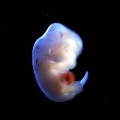 У человеческих эмбрионов возрастом в семь недель ученые нашли «древние мышцы»