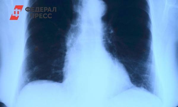 Жители Карелии чаще всего умирают от онкологии дыхательных органов