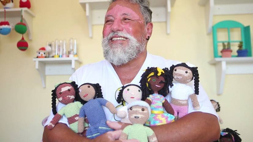 «Надо подружиться со своей болезнью»: бразилец вяжет кукол в поддержку людей с витилиго