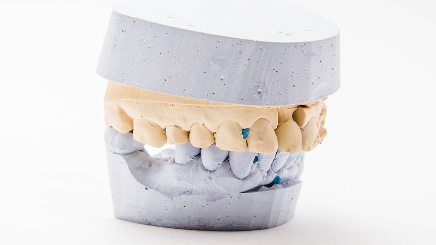 Зубы из стволовых клеток: смогут ли люди навсегда отказаться от протезов?