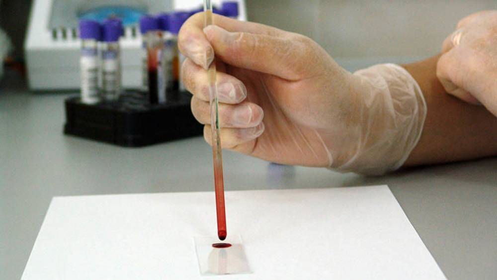 Петербуржцы смогут бесплатно проверить свертываемость крови в трех больницах 14 октября