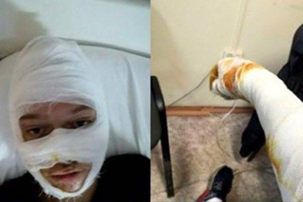 Омбудсмен рассказала о состоянии пострадавших иркутских подростков в полицейской машине