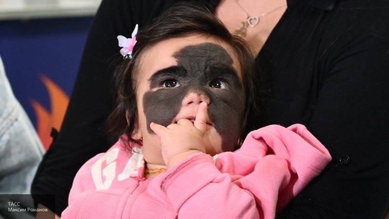 Американскую девочку с пятном на все лицо прооперировали в Краснодаре