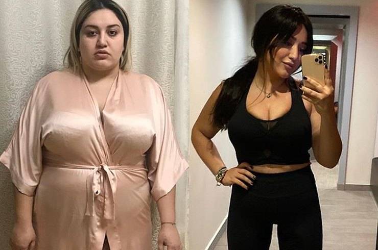 «Минус 43 кг»: Гоар Аветисян показала свои фото до и после похудения