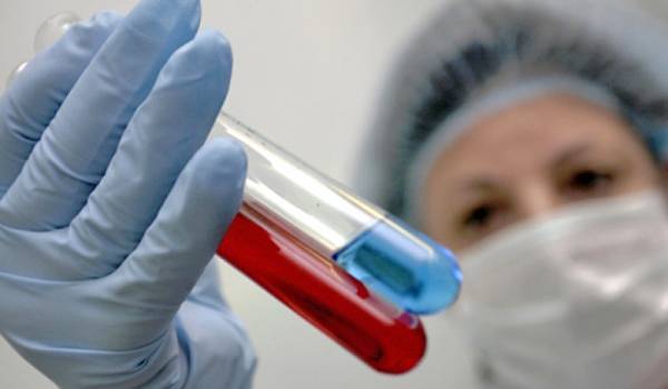 Впервые за 20 лет обнаружен новый штамм ВИЧ