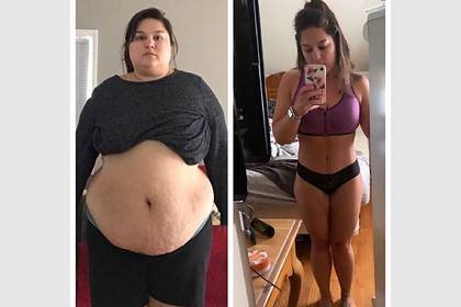 Страдающая ожирением женщина похудела на 57 килограммов и лишилась друзей