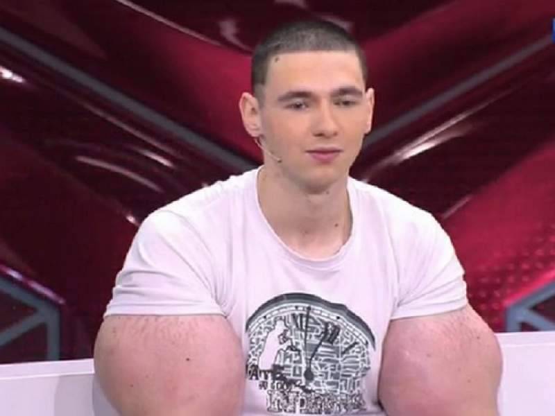 Кирилл Терешин показал "руки-базуки" после операции