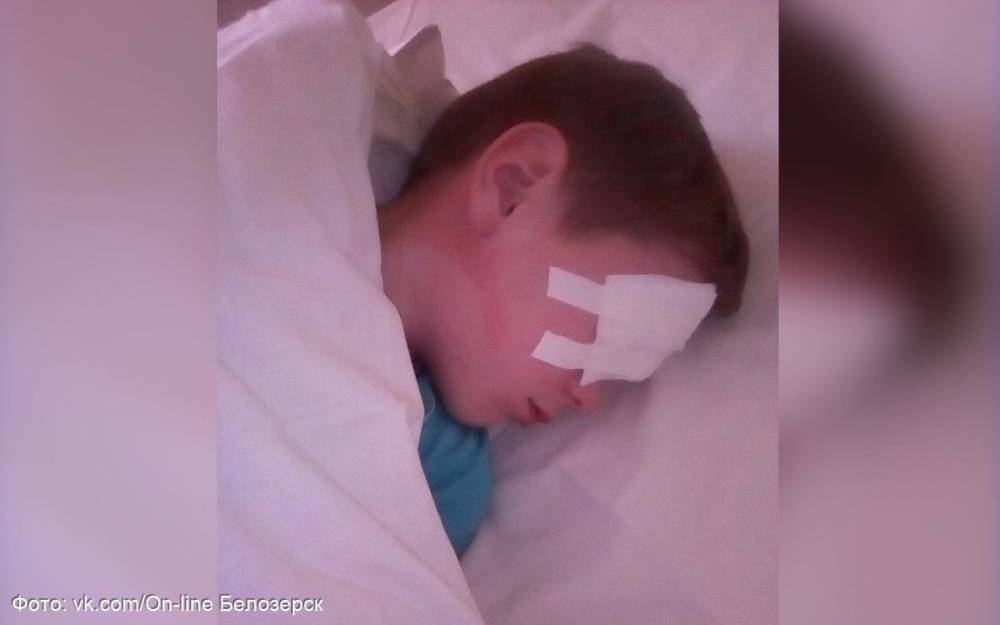 Школьника из Белозерска, которому проткнули глаз ручкой, избили по дороге домой