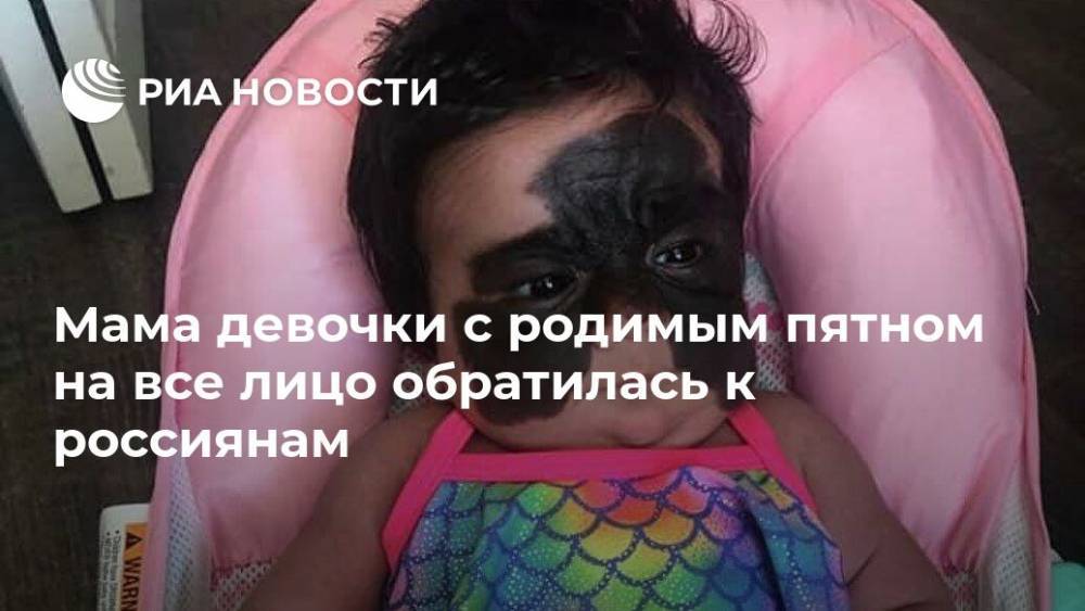 Мама девочки с родимым пятном на все лицо обратилась к россиянам
