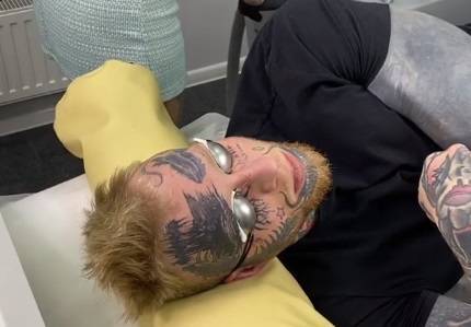 «Неприятно, но быстро»: сын Елены Яковлевой начал удалять татуировки с лица