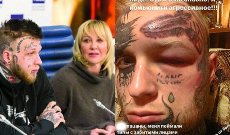«Оскорбил культуру»: сына Елены Яковлевой избили за удаление татуировок с лица