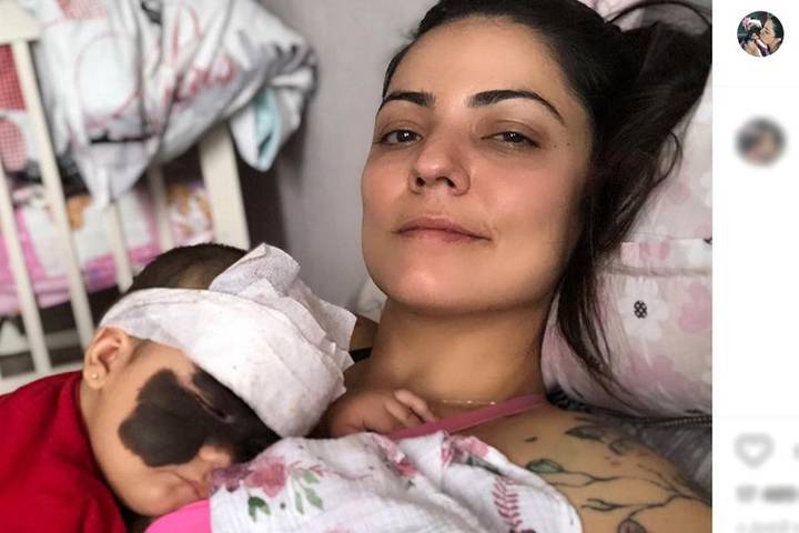 Мать девочки с родимым пятном на все лицо поблагодарила россиян