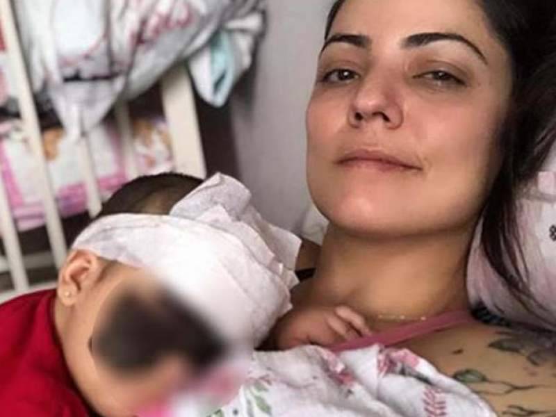 Мать девочки с родимым пятном на все лицо заговорила по-русски