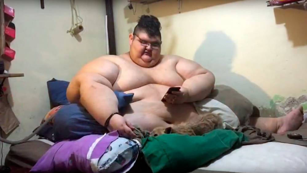 Самый толстый человек в мире похудел на 330 кг