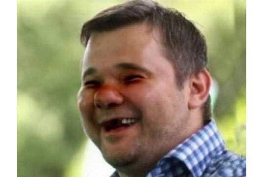 Глава офиса Зеленского выложил фотографию без зубов после сообщения о драке