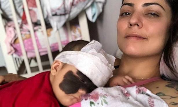 Мать девочки с родимым пятном на лице поблагодарила россиян за помощь
