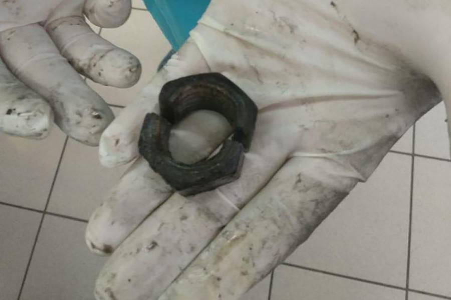 Спасатели спилили гайку с пениса мужчины в Подмосковье