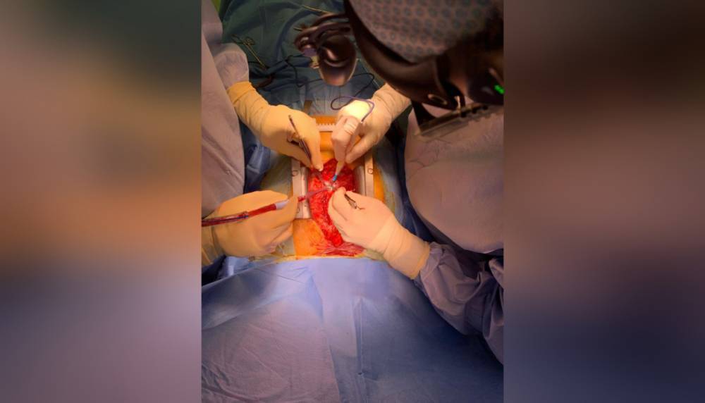 В Центре Алмазова женщине с редкой патологией провели операцию на сердце