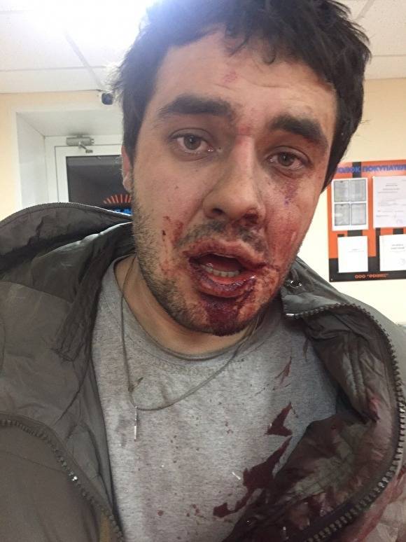 В Челябинске шестеро парней с битой избили депутата из-за сделанного им замечания