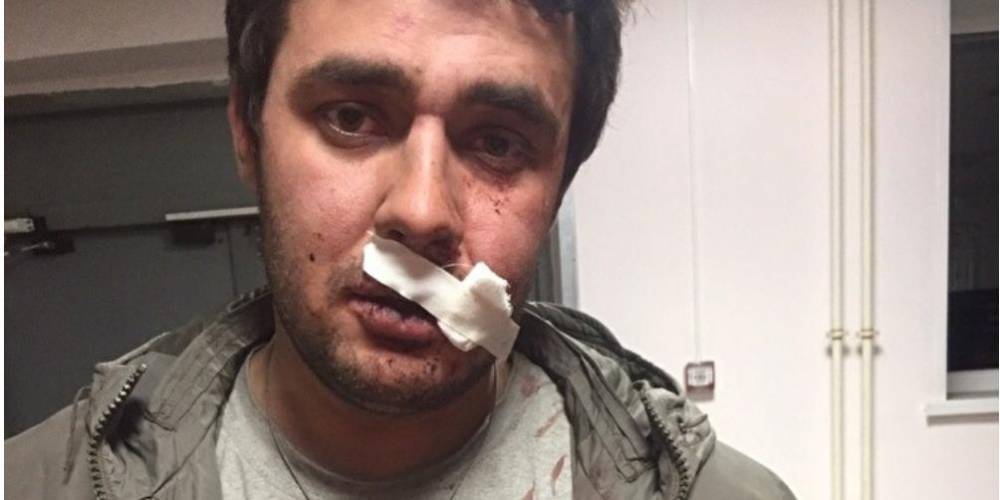 Шестеро пьяных челябинцев избили депутата и порвали ему щеку за замечание о шуме