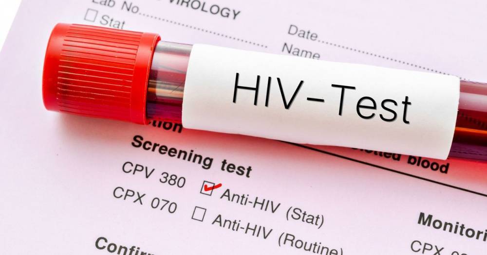 Найден первый за&nbsp;20 лет новый штамм ВИЧ
