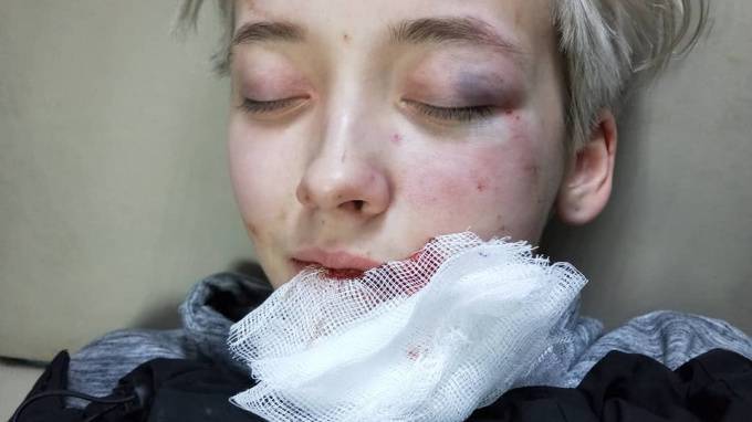 Семеро на одну. В центре Петербурга избита 18-летняя девушка