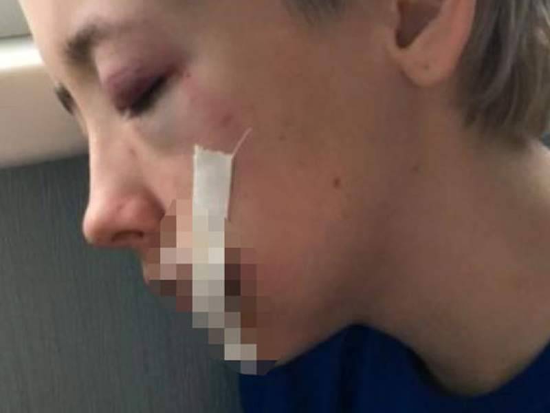 Девушку в центре Петербурга избили семеро мужчин