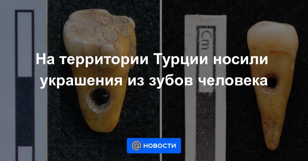 На территории Турции носили украшения из зубов человека