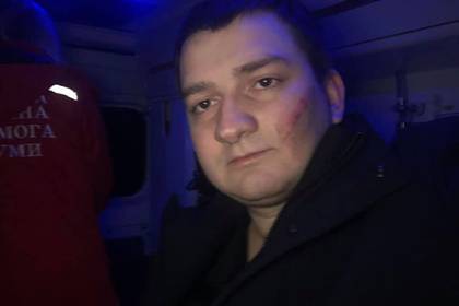 Избиение депутата от партии Зеленского оказалось инсценировкой силовиков