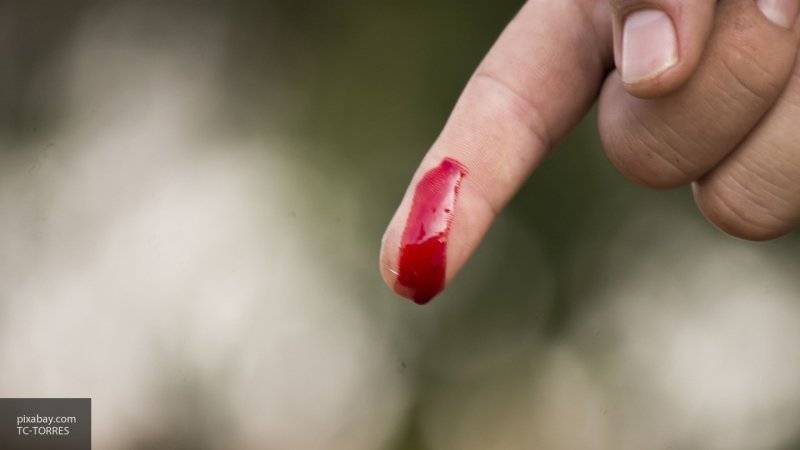 Восьмилетняя девочка из Индии плачет и потеет кровью из-за редкого заболевания