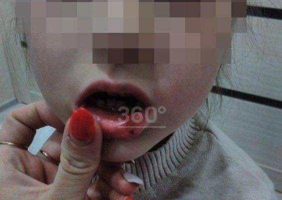 Воспитательницу детского сада в Новосибирске обвинили в избиении ребёнка