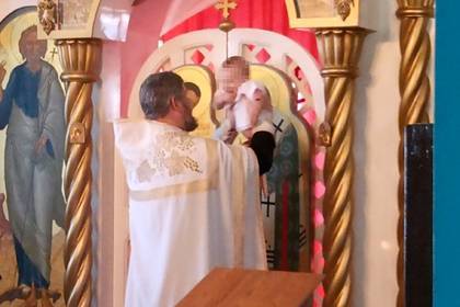 Епархия закрыла вопрос с крещением российской девочки с «заразным» родимым пятном