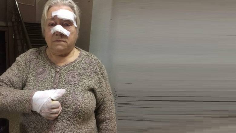 Травмированную пенсионерку из Твери заставили идти в больницу пешком